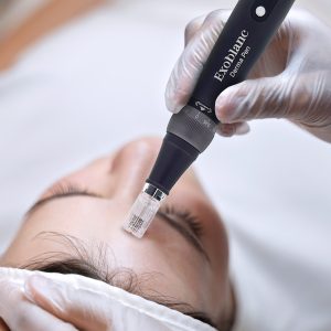 Máy phi kim Exoblanc Derma Pen - Ảnh 3