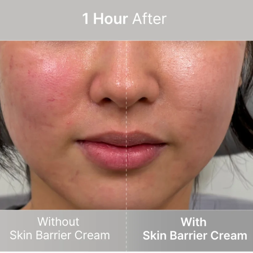 Exoblanc Skin Barrier Cream – Kem Dưỡng Phục Hồi Hàng Rào Bảo Vệ Da - Ảnh 8